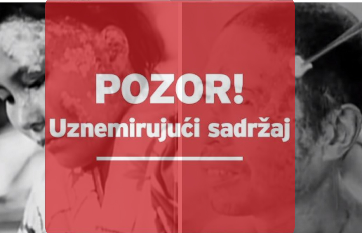 'Ljudi isprva nisu shvatili što se dogodilo. A onda su im počeli izlaziti gnojni mjehurići po koži'
