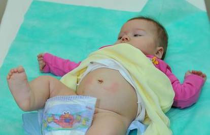 Klaićeva: Bebi su izvadili tumor s jajnika bez rezova