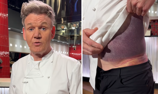 Gordon Ramsay doživio tešku biciklističku nesreću: 'Da nisam nosio kacigu ne bih bio ovdje'