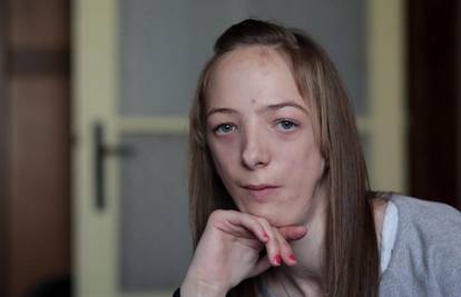 Marija (16) želi biti zdrava kao i njena sestra blizanka