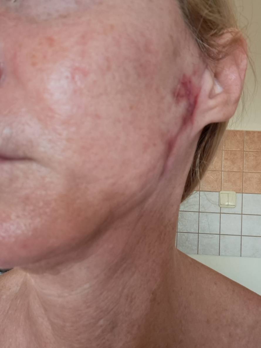 Estetski kirurg iz Zagreba htio ušutkati žene koje su se žalile na njega, stigla mu opomena!