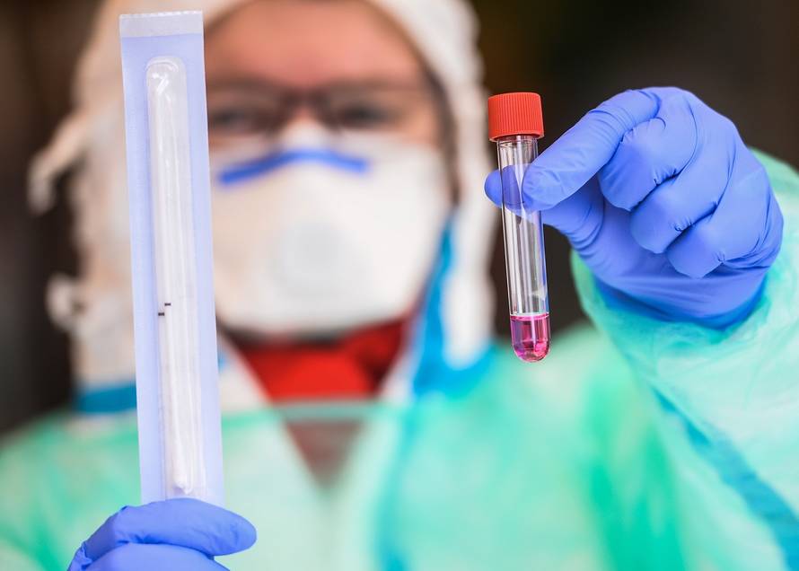 Nastavni zavod za javno zdravstvo "dr. Andija Štampar" uveo "drive in" dijagnostiku koronavirusa