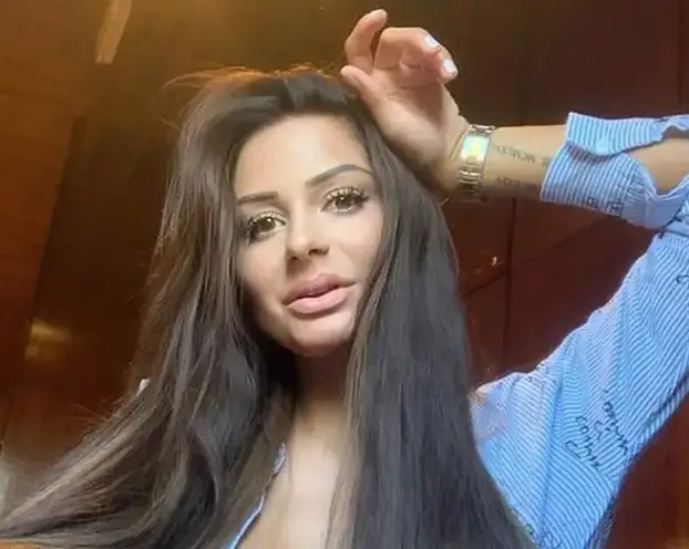 Na istog se estetskog kirurga žalila i Kristina Mandarina. Pogledajte kako je izgledala