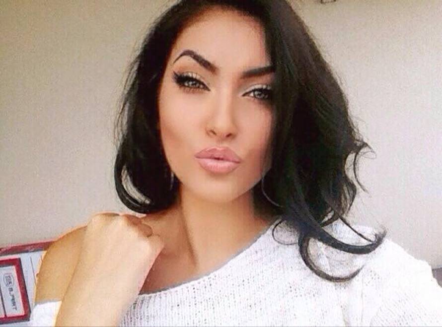 Kako su Soraja, Hana i Kristina izgledale prije odlaska pod nož?