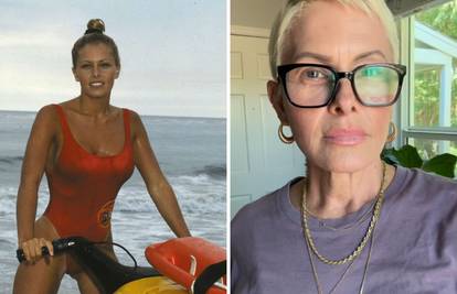 Zvijezda Baywatcha podvrgnula se mastektomiji: Dvije godine se već bori s rakom dojke...
