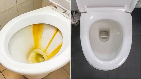 Mama otkrila trik kako čisti WC od kamenca: 'Stavim malo ovog praha i ujutro samo isperem'