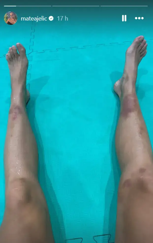 FOTO 'Ponekad nakon borbi ne mogu hodati': 'Kninska kraljica' pokorila je i Olimpijske igre