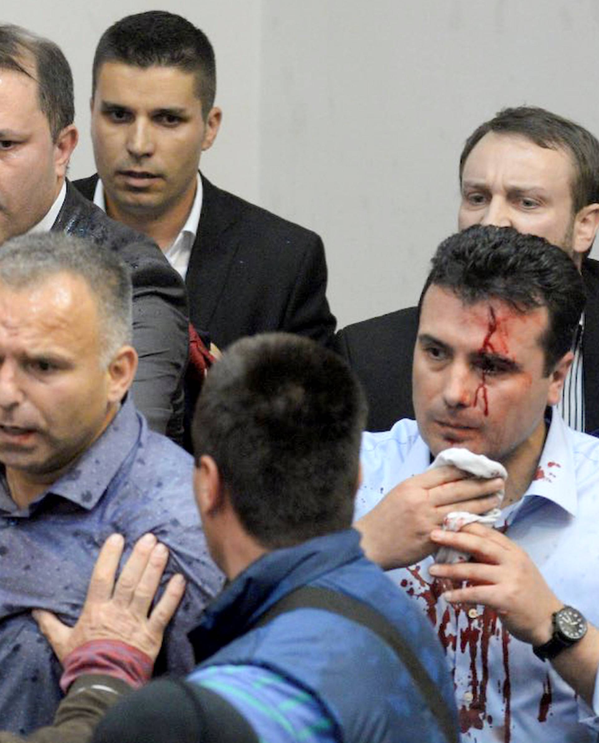 An injured leader of the Social Democrats Zoran Zaev is escorted out of the parliament in Skopje