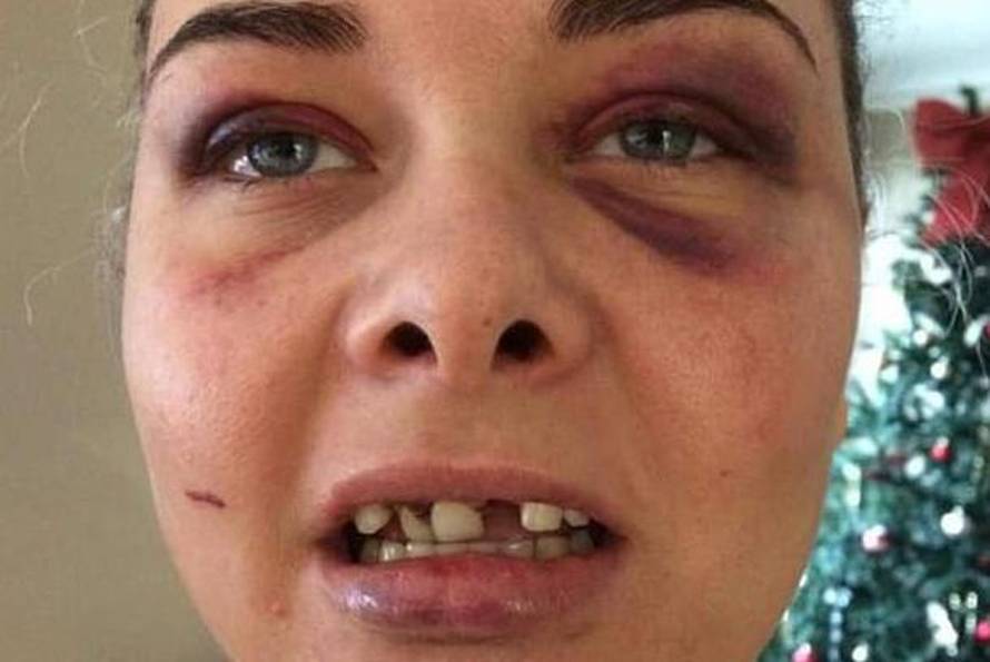 Razbio je djevojci zube jer ga je maknula s profilne fotografije