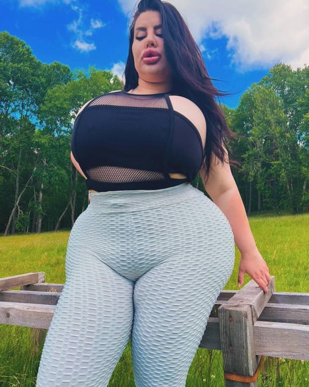 FOTO Stražnjica mi teži 45 kila, no već imam u planu sljedeću operaciju, želim imati najveću!