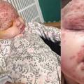 Mama otkrila šokantne prizore bebe s herpesom: Ne ljubite je