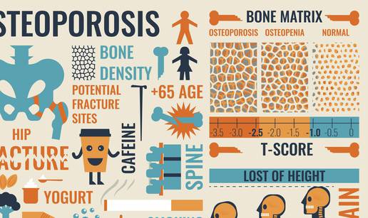 Čuvajte se: Osteoporoza jedna od 10 najčešćih bolesti danas