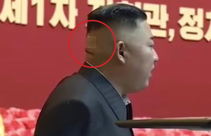 Misteriozna rana Kim Jong Una: Snimili ga s flasterom i mrljom na glavi - što mu se dogodilo?