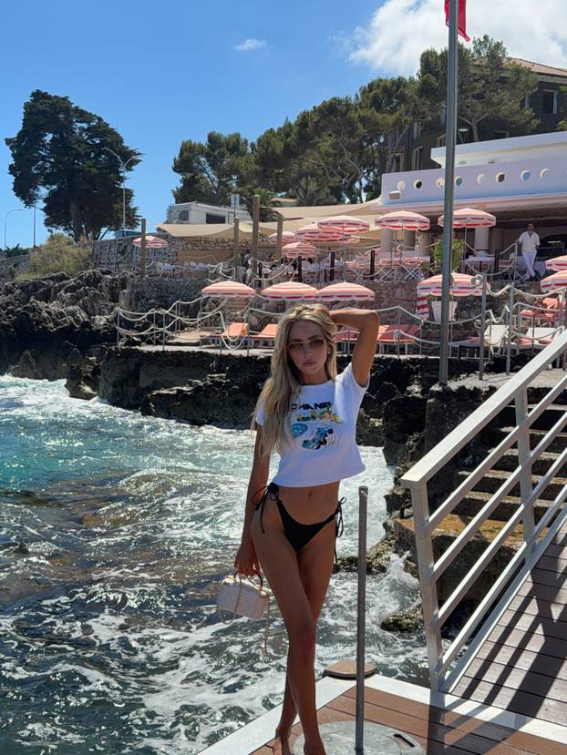 FOTO Pokazala nesavršenosti i zaludila internet: 'Želim da akne postanu seksi'