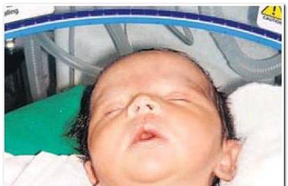 U Indiji tek rođenoj bebi ugradili pacemaker