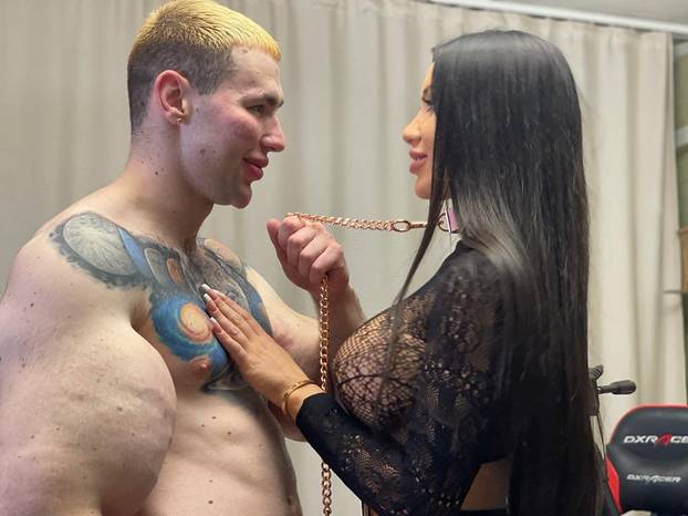 FOTO 'Ruski Popaj' mogao bi izgubiti obje ruke zbog teške infekcije: Ubrizgava kemikalije!