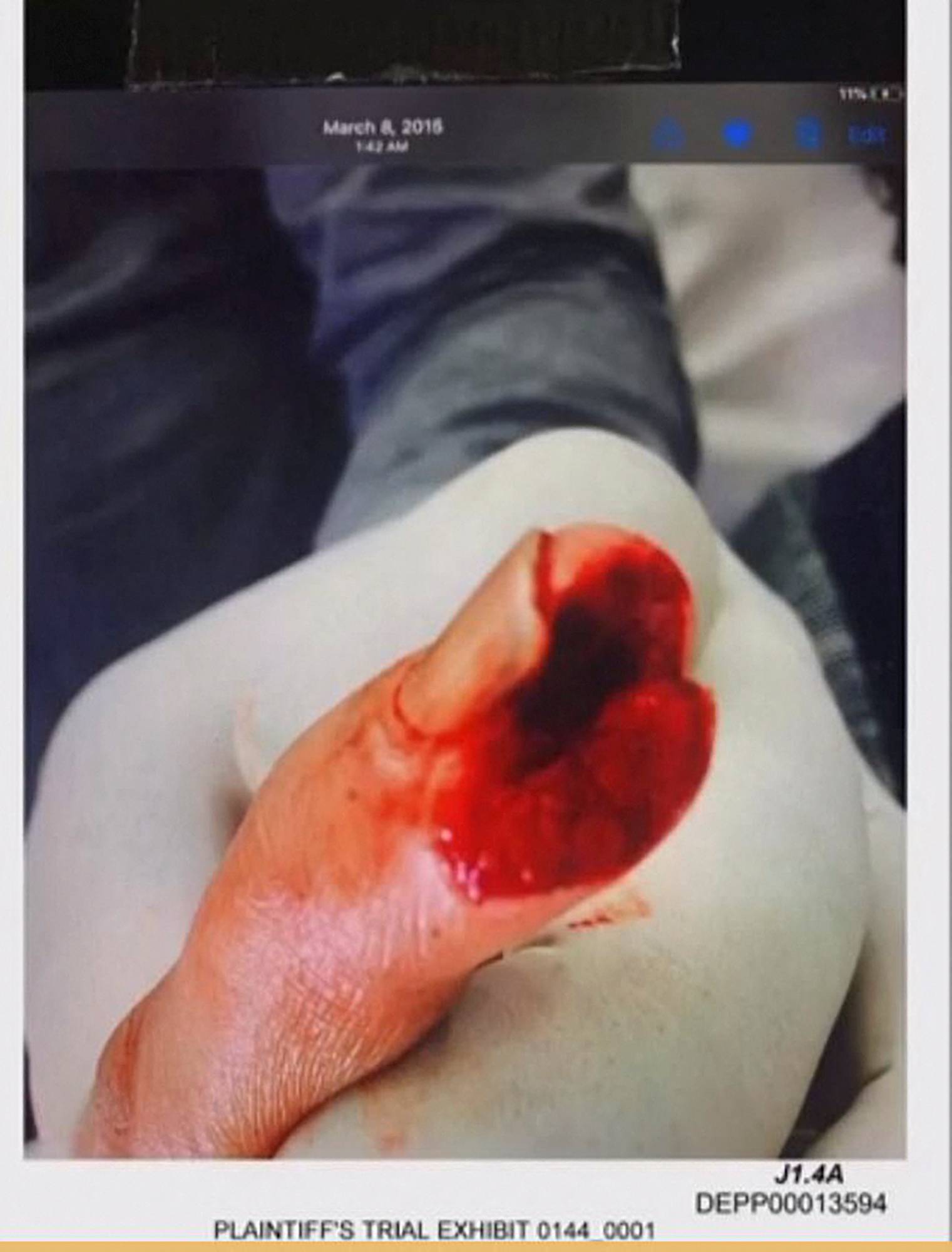 Courtroom video display shows actor Johnny Depp's injured finger