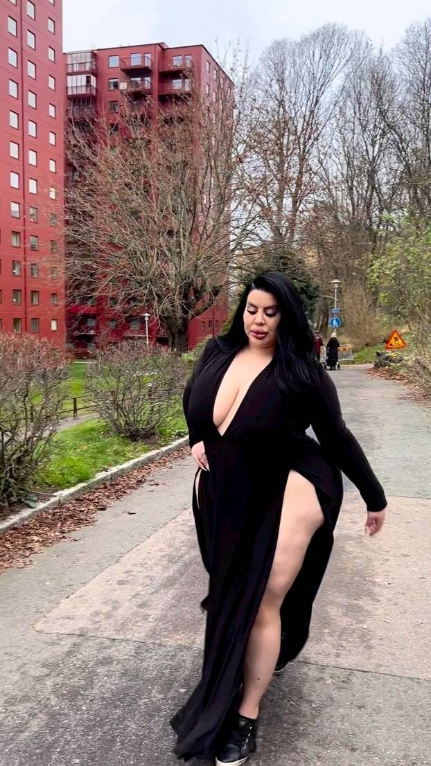 FOTO Stražnjica mi teži 45 kila, no već imam u planu sljedeću operaciju, želim imati najveću!