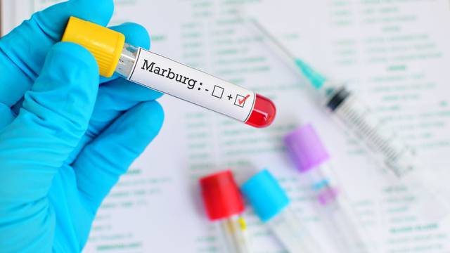 Prvi slučajevi smrtonosnog marburškog virusa otkriveni u Gani: U karanteni je 90 ljudi...