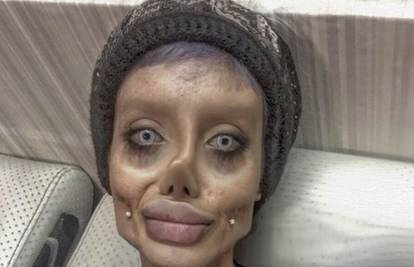 Evo kako  je 'dvojnica' Angeline Jolie izgledala prije operacija...