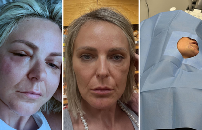 Potresno! Stankica je podijelila fotke lica: Uništili ste mi tijelo i uzeli dostojanstvo, ali živa sam