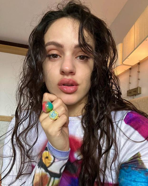 FOTO Ova španjolska diva ima dva Grammyja: Publiku osvaja svojim specifičnim zvukom