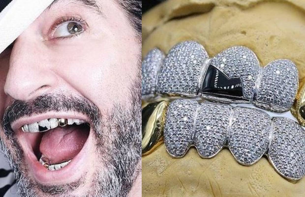 Marc Jacobs dao si je napraviti navlake za zube od dijamanata
