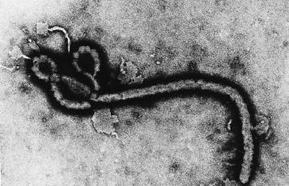Od virusa ebole preminulo više od 100 ljudi u Gvineji i Liberiji