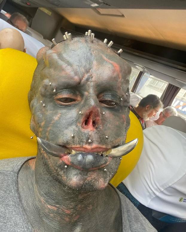 FOTO Uznemirujuće! Uklonila je čak i vrh nosa, a evo kako je izgledala: Šteta, ljepotica si bila