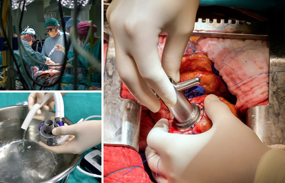 24sata u operacijskoj sali: 'Ugradili smo najnoviji uređaj koji pacijentu mijenja pola srca'