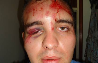 Strava u Splitu: Mladića napali i pokušali ga skalpirati na ulici