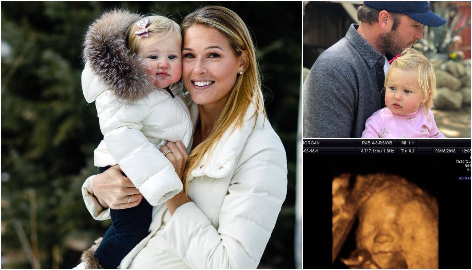Millerova žena: Na ultrazvuku sam vidjela preminulu kćerkicu