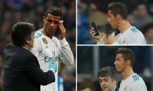 Ronaldo dobio nogom u glavu pa se krvav ogledao u mobitelu