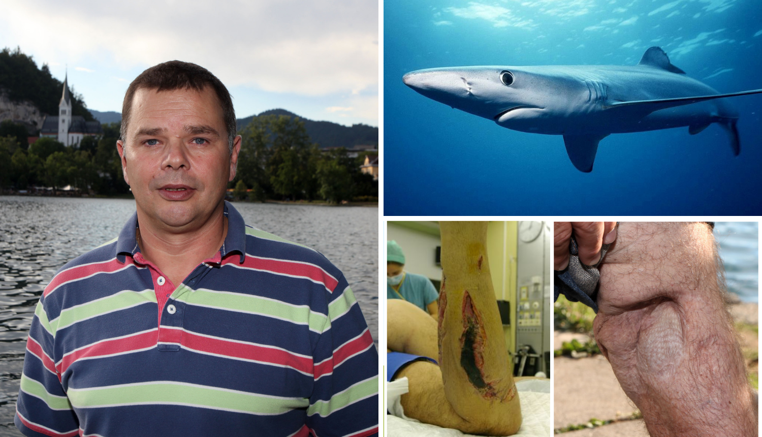 Napao ga morski pas: Slovenac Damjan i dalje roni u Jadranu