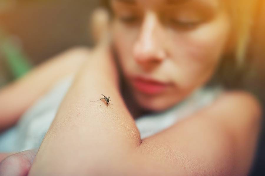 A Mosquito Sits On The Womans Hand, And Sucks Blood. Pain, Dange