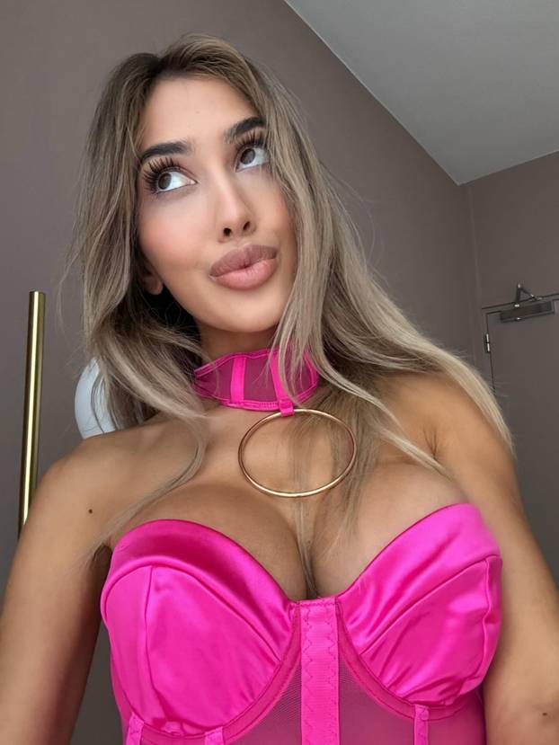 FOTO Sve joj je na mjestu! Prije su je ismijavali, danas zarađuje ogromne cifre kao model