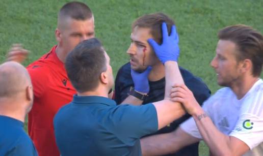 Dinamov liječnik pregledavao krvavog Roga, Rakitić ga tjerao