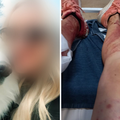 Strava kraj Splita: Vučjak izletio iz dvorišta i izgrizao ženu, psu smrskao čeljust, na operaciji je