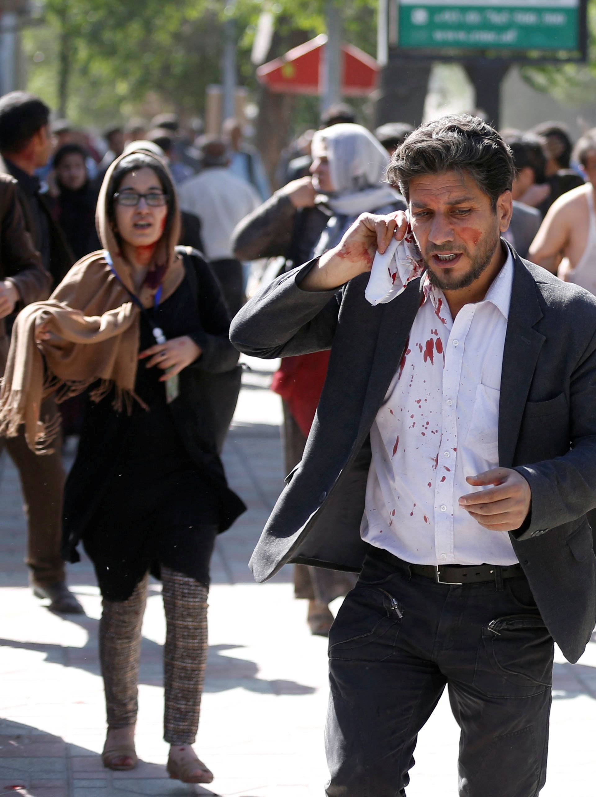 Injured Afghans run from the site of a blast in Kabul, Afghanistan