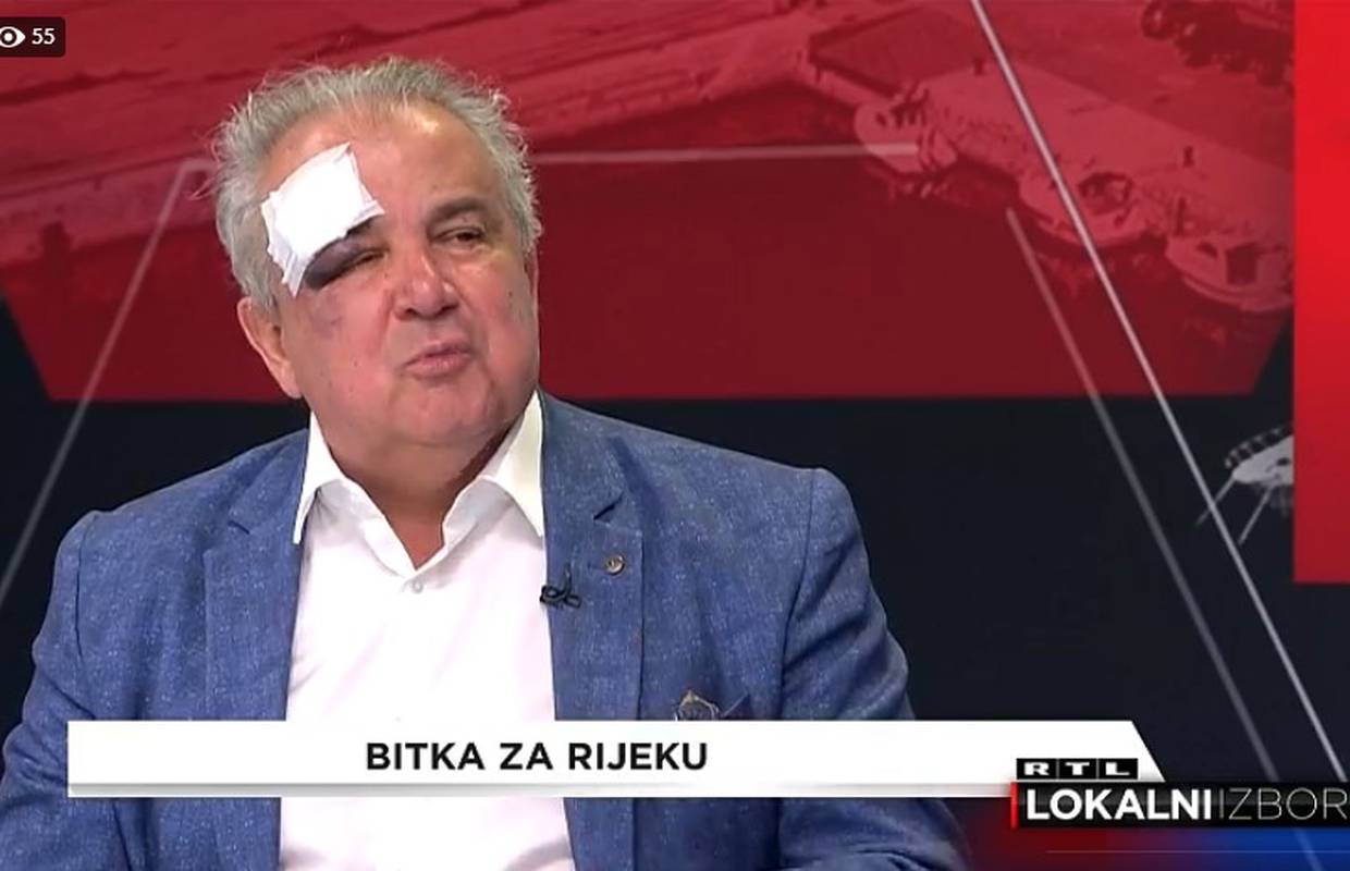 Utrka za Rijeku: Ivaniš s gazom preko čela i zatvorenim okom nakon sudara na sučeljavanje