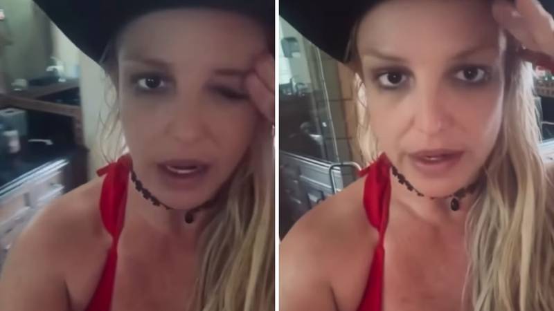 Britney Spears podijelila svoje neugodno iskustvo s botoksom