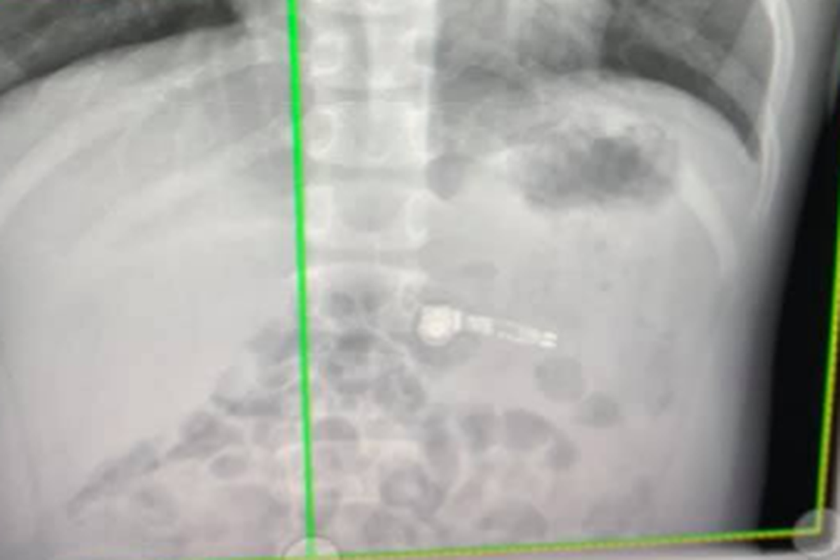 Roditelji, pripazite na djecu! Po novome, jedu AirPod slušalice