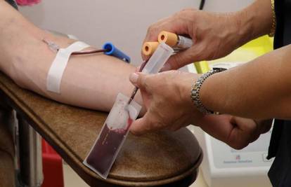 Nestašica krvi u KBC-u Split, pozivaju građane na darivanje