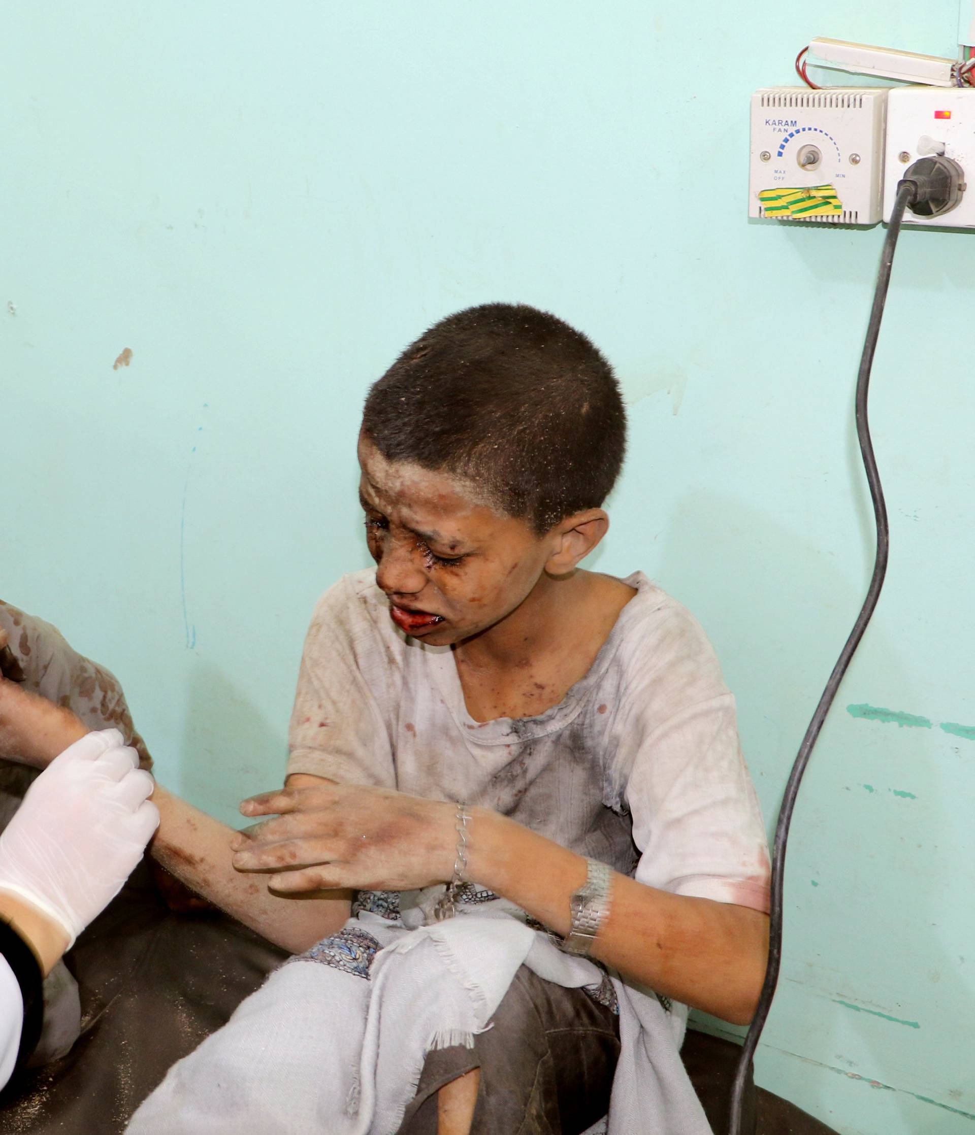 A doctor treats children injured by an airstrike in Saada