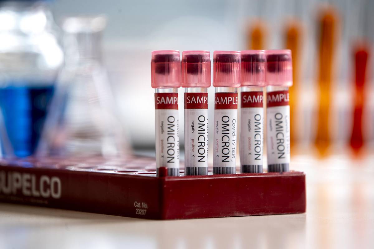 U Zadarskoj županiji novih 63 slučajeva zaraze koronavirusom