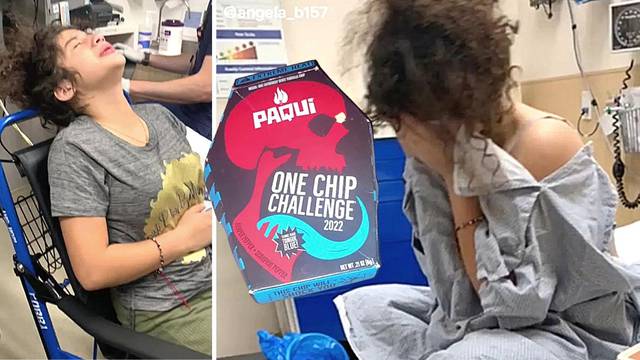 Širi se opasni trend: Zbog čipsa s najljućom papričicom djeca u bolnicama, bolovi traju satima