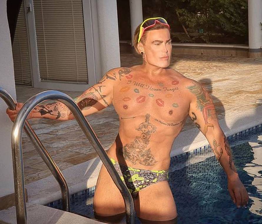 Cigi: Imao sam 10-ak operacija, sad je dosta. Silikon iz usta sam izvadio, ne želim pačji izgled...