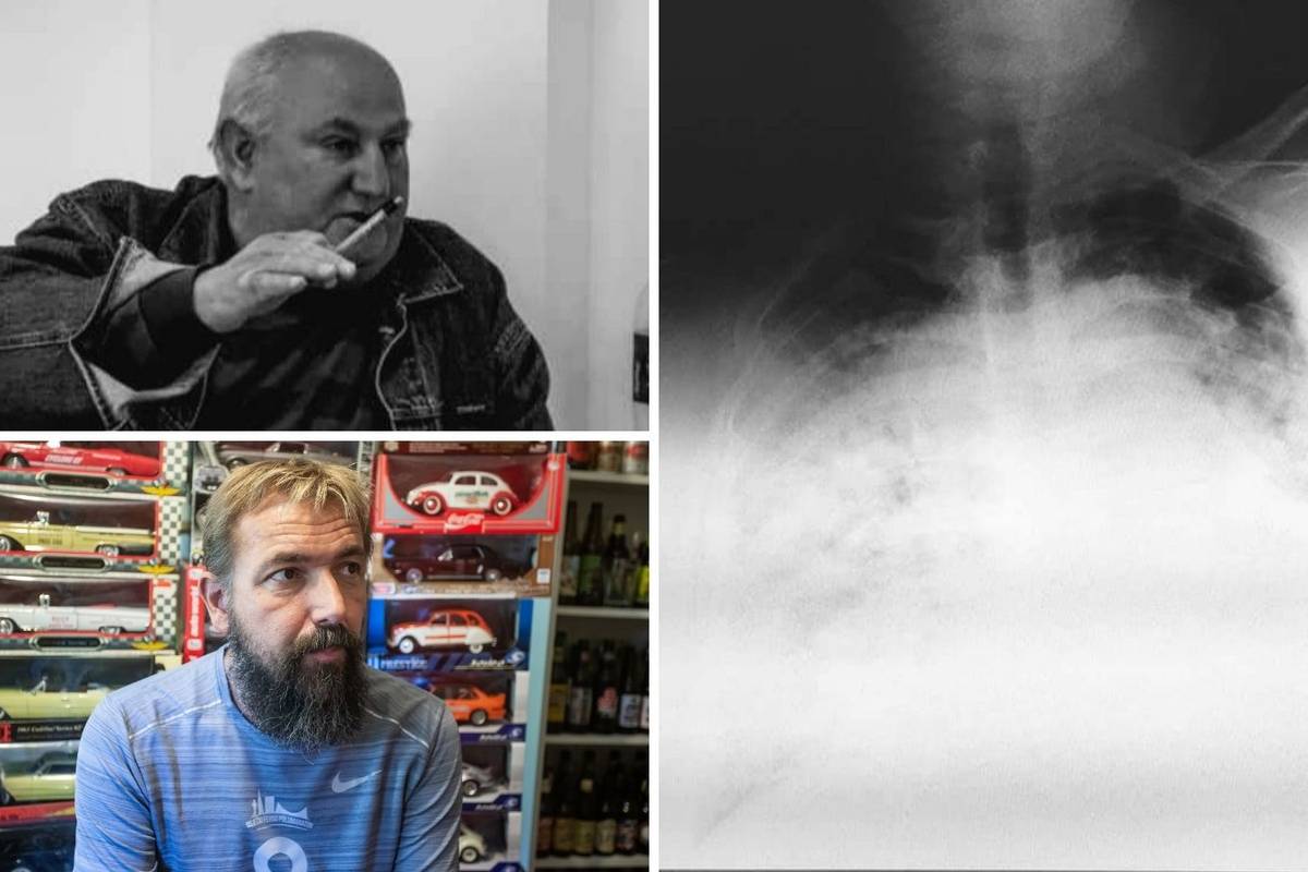 "Pluća su mu gotovo nestala pod virusom, rekao mi je: J..i ga kolega, znam da sam loše..."