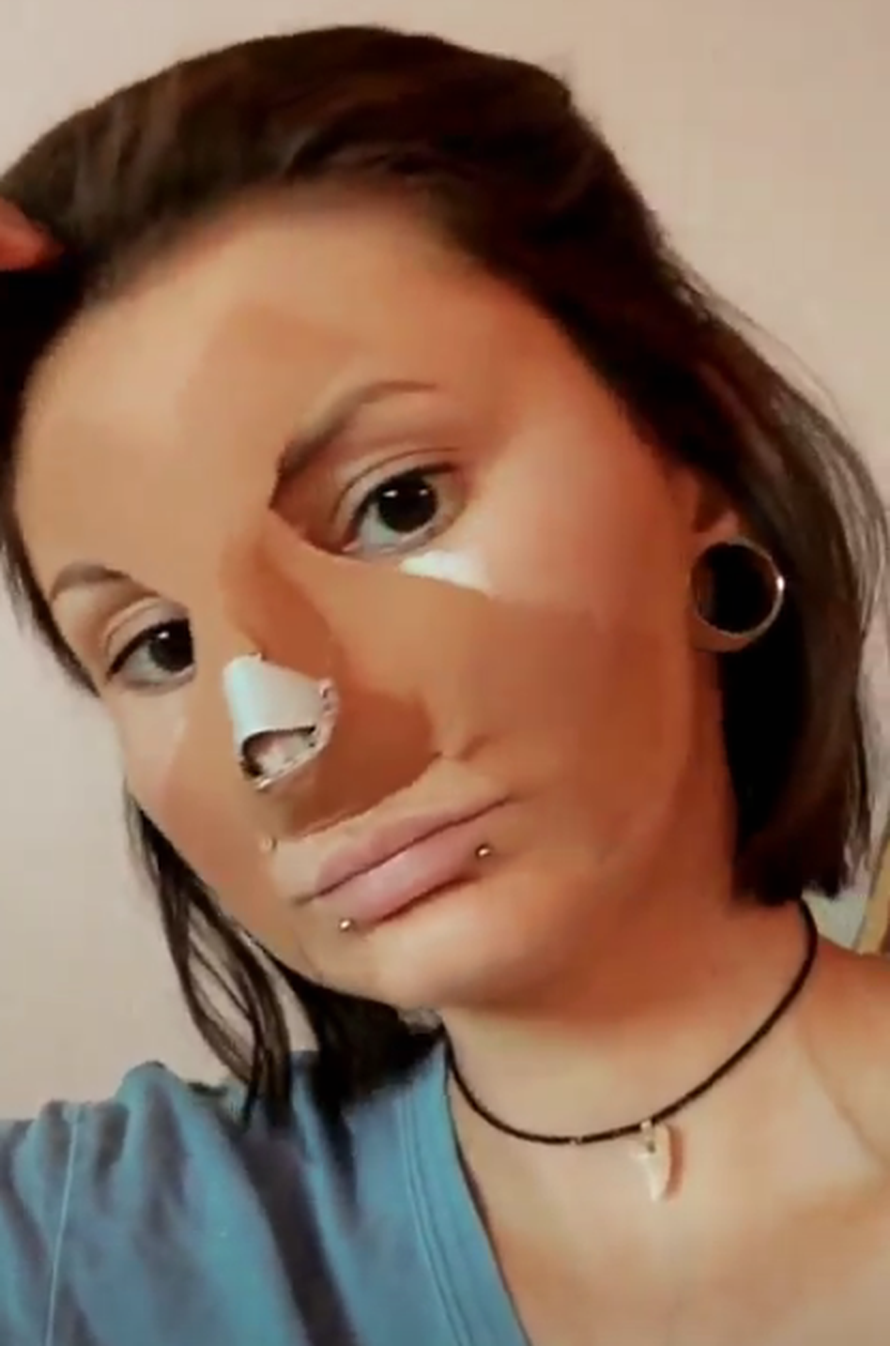 Ozana je nekada pohala tikvice, a sad se odvažila i operirala nos