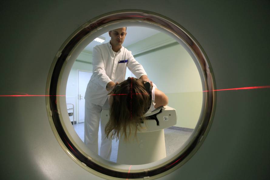 Rano otkrivanje raka pluća CT-om značajno smanjio smrtnost